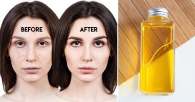 moisturizers 