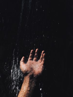 dandruff 