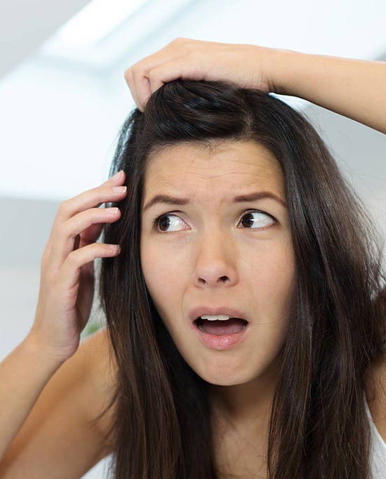 dandruff