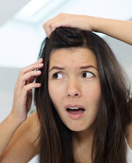 dandruff